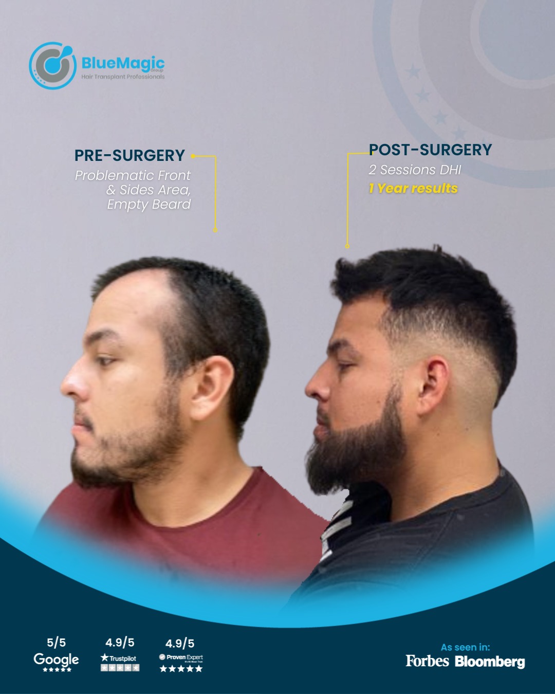 hair transplant clinic